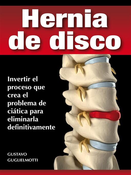 Title details for Hernia de disco--cerrar sin cirugía by Gustavo Guglielmotti - Available